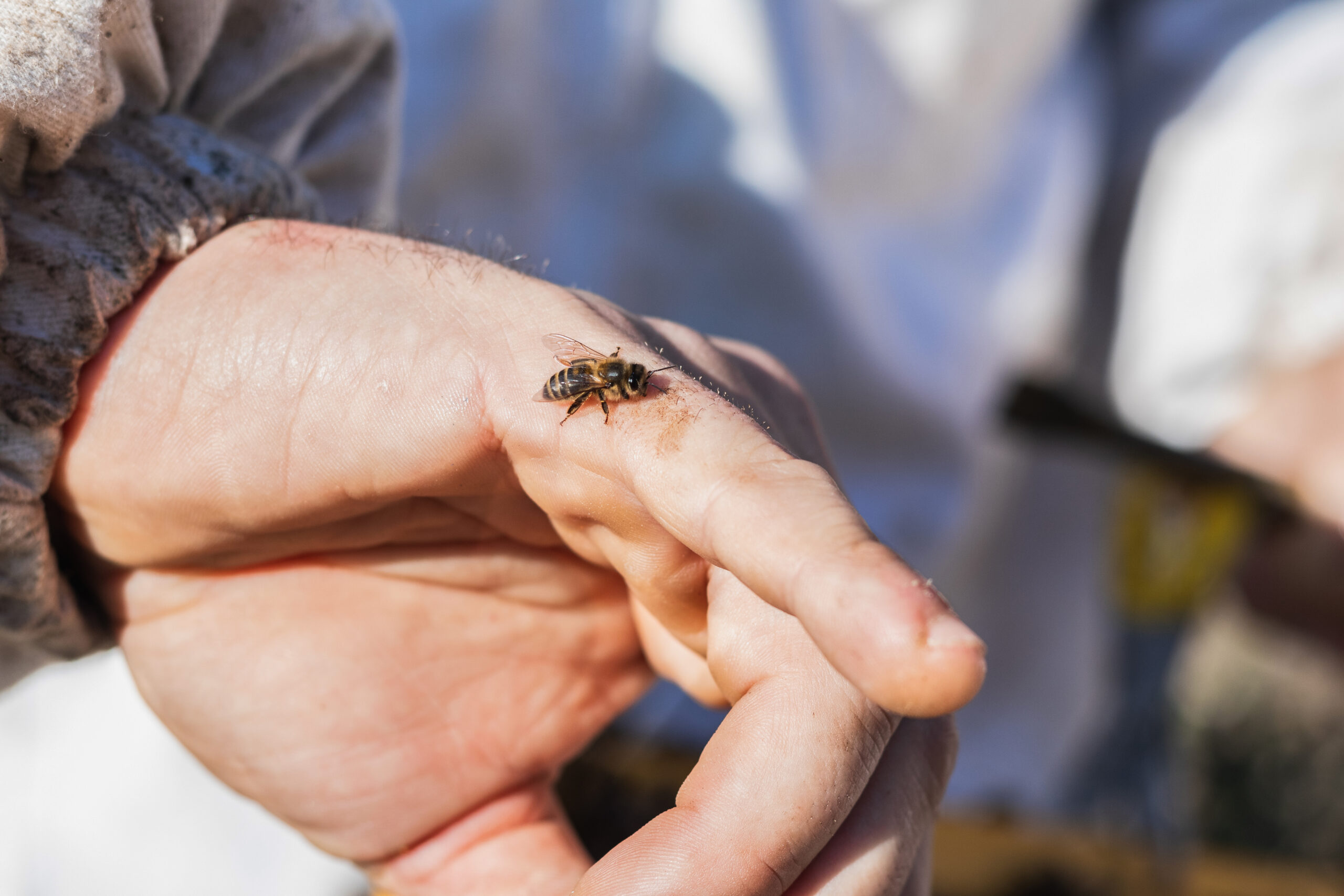 Treatment for Wasp Sting
